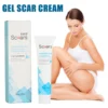 20g Scar Removal Cream For Old Scars And Gel Removal Ointment From Keloid Treat Surgery Scars Stretch Marks Acne Pox Prints Burn