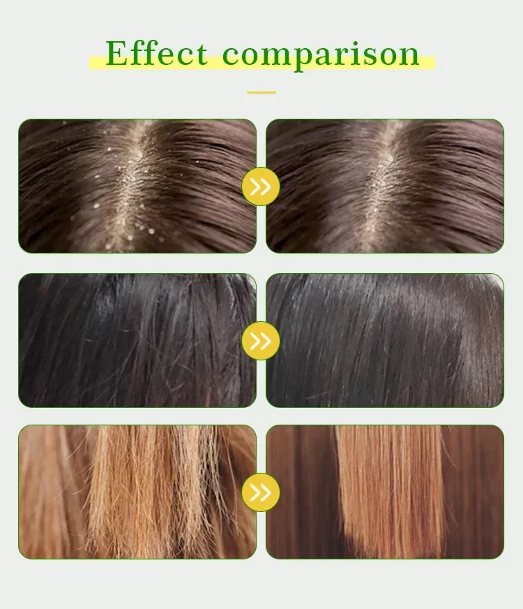 473ml Plant tea tree oil shampoo Moroccan Argan Oil Shampoo Conditioner Home Care Set hair shampoo and conditioner hair care - Image 4