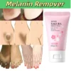 Melanin Remover Skin Lightening Body Lotion Bleaching Armpits Elbows Knees Moisturizing Skincare Inner Thigh Brighten Cream