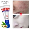 BIOAQUA Acne Removing Cream Acne Treatment Blackhead Removal Cream skincare Shrink Pores Anti-acne Creams Facial Skin Care